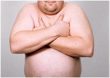 Impotncia sexual masculina em obesos